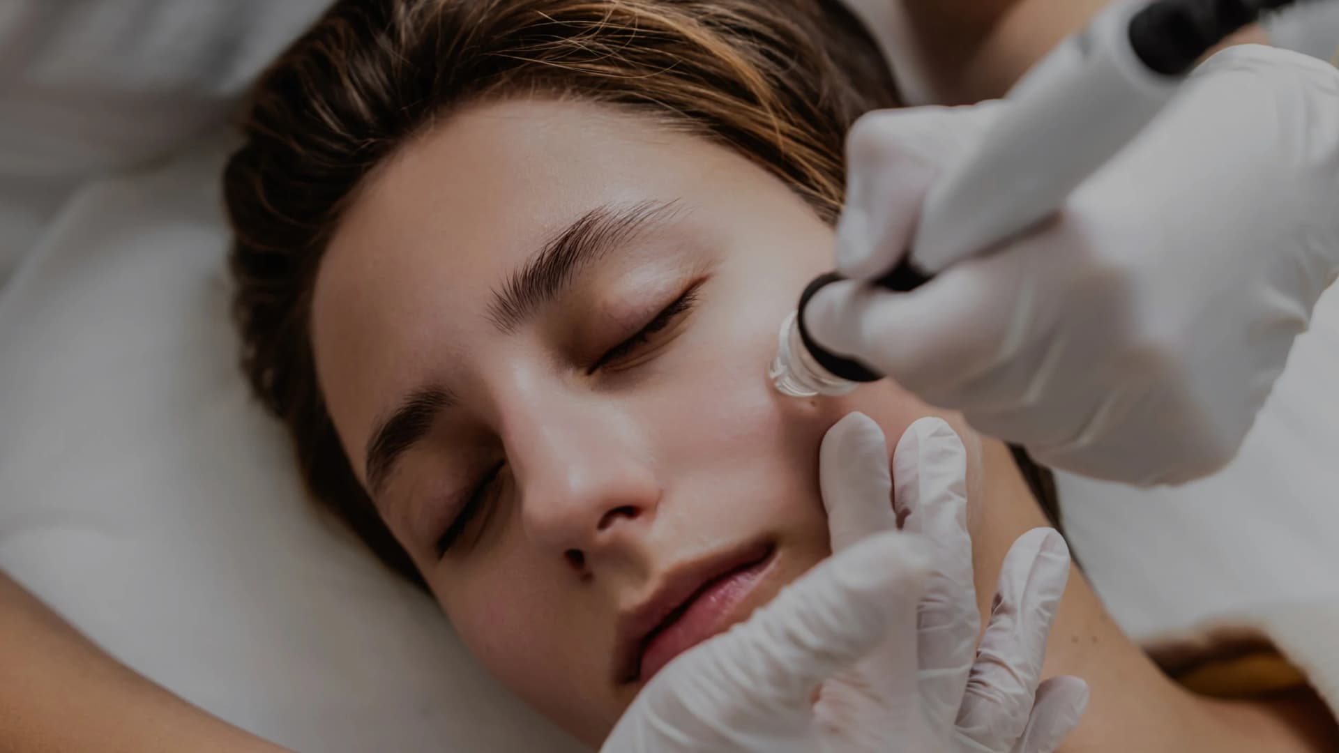 Hydrodermabrasion Near Me – Deep Hydration and Skin Renewal